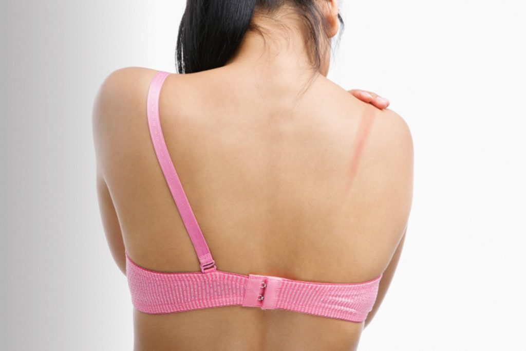 Tight Straps Digging Into Your Shoulders? Zivame