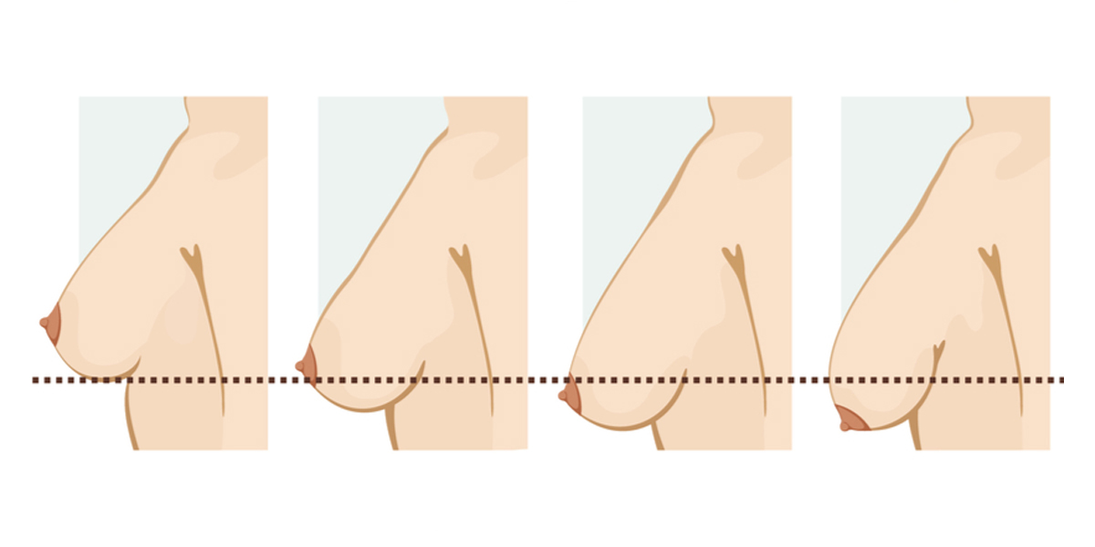 What type of bra is good for breast Clearance